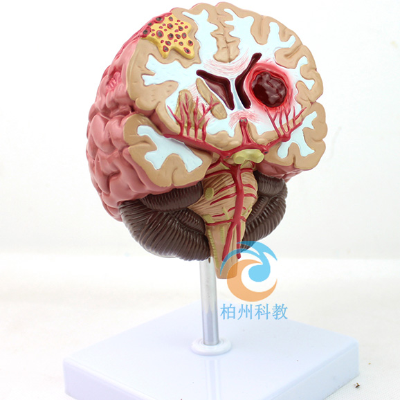 ���X����ģ��