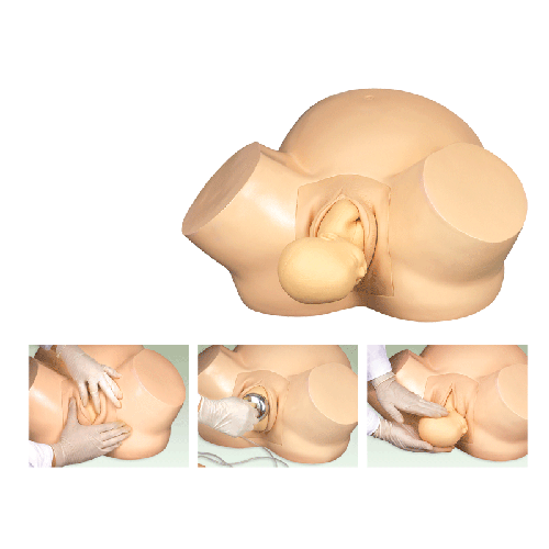 혮a(ch��n)Ӗ(x��n)��ģ��