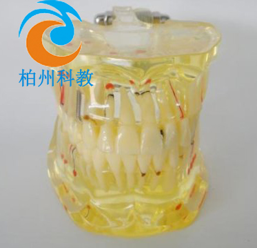 ͸�����w����ģ��