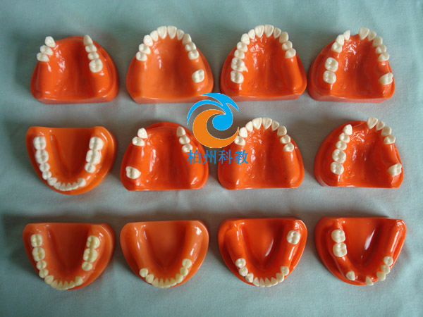 �pɫ����ȱʧģ��