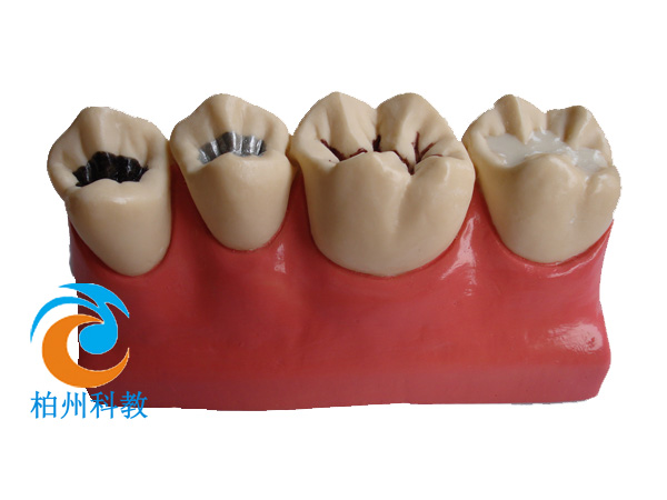 4���C�Ϸ��]ģ��