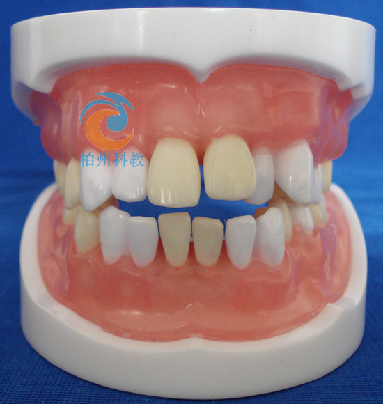 �t(y��)���Y��ԇ����ģ��