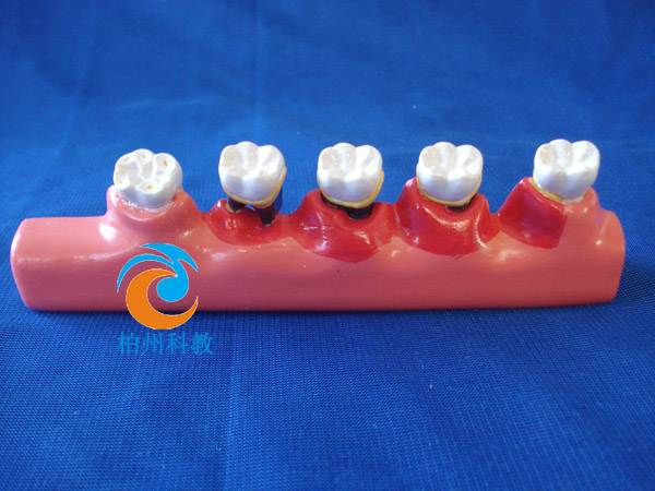 2�����ܲ��M(j��n)չģ��