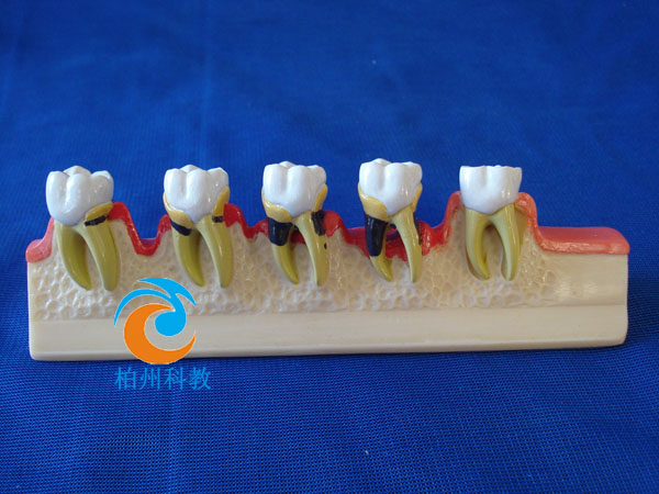 2�����ܲ��M(j��n)չģ��