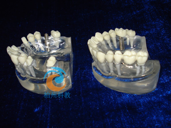 ���w�Nֲ�w�c���ɘ��w�ޏ�(f��)��(du��)��ģ��