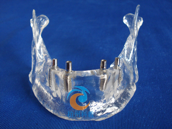 �������M�ǷNֲģ��