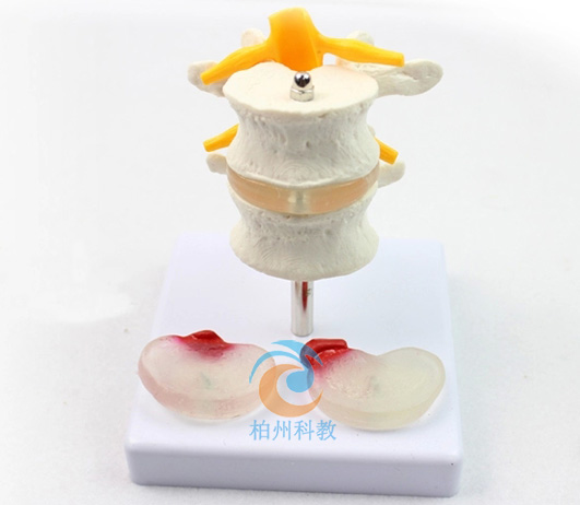 2��(ji��)��׵��2����׃׵�g�Pģ��