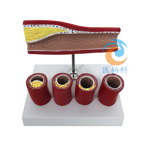 �ڠ��(d��ng)�}��Ӳ����Ѫ˨ģ��