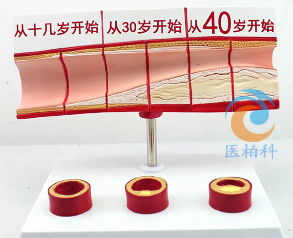 ��ͬ���g�δ�Ѫ��ģ��