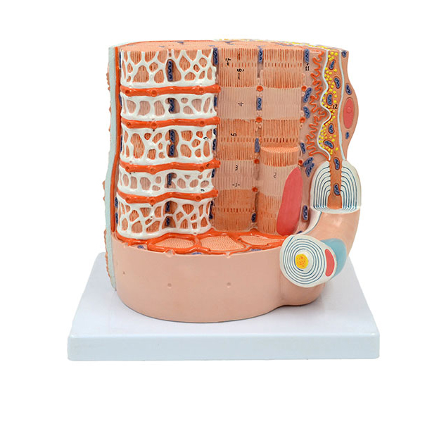 ���w�������w�S�@΢�Y(ji��)��(g��u)�Ŵ�ģ��